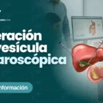 Operacion de Vesicula Laparoscopica